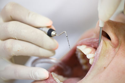 La periodoncia, un valor al alza en la odontología